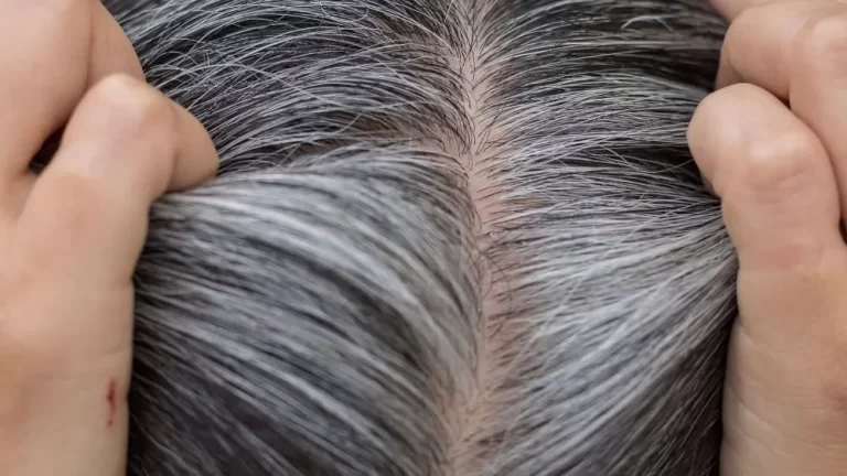 White Hair